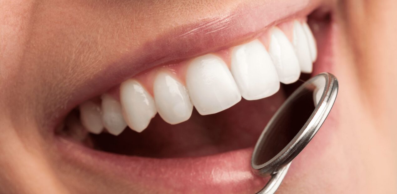 Gros plan d'une personne souriante, montrant des dents propres et blanches, avec un miroir dentaire tenu près de sa bouche lors d'un contrôle au cabinet dentaire iDental Studio.