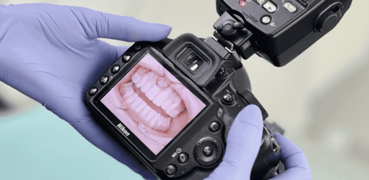 Une personne portant des gants violets tient un appareil photo Nikon affichant une photo en gros plan des dents et des gencives sur son écran, probablement pour la documentation dentaire au iDental Studio ou dans un cabinet dentaire.